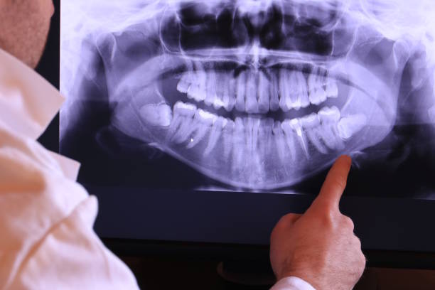Best Broken or Cracked Tooth Emergency Dentist in Carlisle, KY